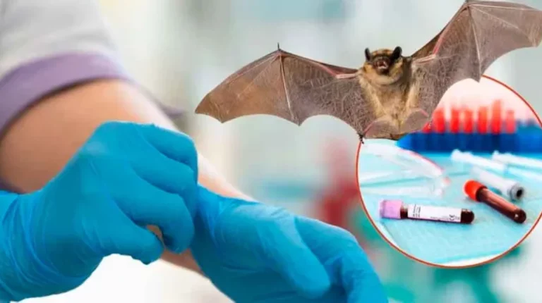 Lo que debes saber sobre el virus de Nipah